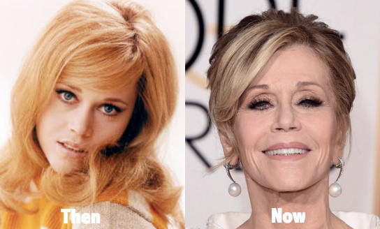 Jane Fonda Is Not Proud of Her Plastic Surgery and Wishes She Was 'Braver': 'But I Am What I Am'