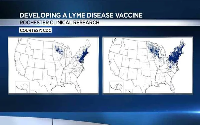 Rochester clinical studies working to develop 1 human Lyme disease vaccine